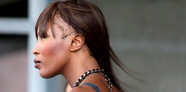 Supermodelis Naomi Campbell kenčia nuo plaukų slinkimo?
